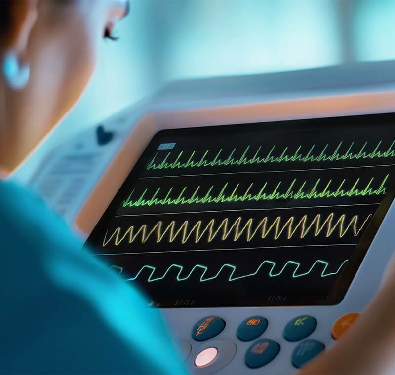 An EKG technician in scrubs attaches electrode leads to a patient’s chest while monitoring a printed electrocardiogram strip and heart-rhythm waveforms on a machine